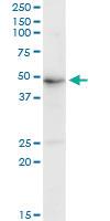 Anti-GRB7 Rabbit Polyclonal Antibody