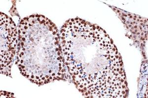 Immunohistochemistry analysis of paraffin-embedded mouse testis using Anti-FUBP1 / FBP Antibody [ARC1403] (A309248) at a dilution of 1:100 (40x lens). Perform microwave antigen retrieval with 10 mM Tris/EDTA buffer pH 9.0 before commencing with IHC staining protocol.