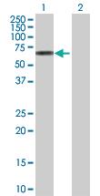 Anti-GRB7 Rabbit Polyclonal Antibody