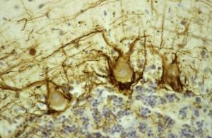 Human cerebellar cortex fixed in formalin, embedded in paraffin and stained with Anti-NF-H Antibody using the ABC (avidin biotin conjugate) method. The section was counterstained with heamatoxylin-eosin (blue).