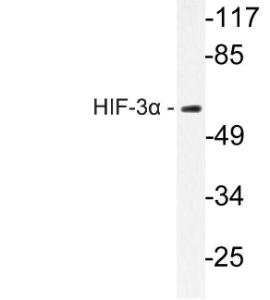 Western blot analysis of lysate from rat brain cells using Anti-HIF-3alpha Antibody