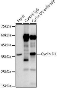 Immunoprecipitation analysis of 300 µg extracts of MCF7 cells using 3 µg of Anti-Cyclin D1 Antibody [ARC0300] (A306339). This Western blot was performed on the immunoprecipitate using Anti-Cyclin D1 Antibody [ARC0300] (A306339) at a dilution of 1:1000