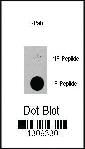 Anti-PDPK1 Rabbit Polyclonal Antibody