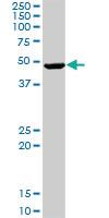 Anti-GRB7 Rabbit Polyclonal Antibody