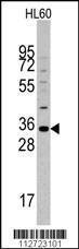 Anti-MOGT2 Rabbit Polyclonal Antibody (AP (Alkaline Phosphatase))