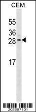 Anti-EPO Mouse Monoclonal Antibody [clone: 511CT20.2.4]