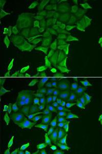 Immunofluorescence analysis of HeLa cells using Anti-CD84 Antibody (A9865). DAPI was used to stain the cell nuclei (blue).