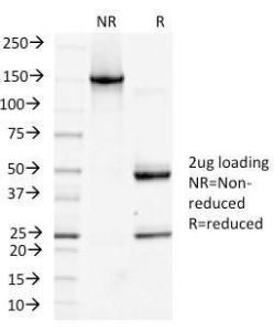 SDS-PAGE analysis of Anti-Podocalyxin Antibody [PDPN/1433] under non-reduced and reduced conditions; showing intact IgG and intact heavy and light chains, respectively. SDS-PAGE analysis confirms the integrity and purity of the antibody