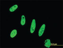 Anti-BIRC5 Mouse Monoclonal Antibody [clone: 5B10]