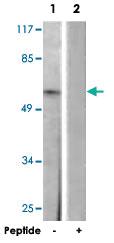 Anti-IL2RA Rabbit Polyclonal Antibody