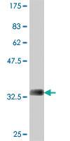 Anti-STK16 Mouse Polyclonal Antibody