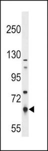 Anti-PKLR Rabbit Polyclonal Antibody (APC (Allophycocyanin))