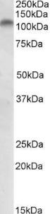 Anti-PLK4 Antibody (A83816) (2 µg/ml) staining of Human Colon lysate (35 µg protein in RIPA buffer). Primary incubation was 1 hour. Detected by chemiluminescence