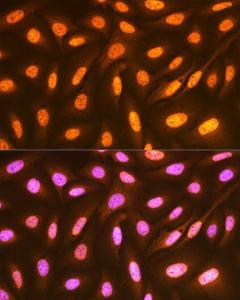 Immunofluorescence analysis of U-2 OS cells using Anti-FUBP1 / FBP Antibody [ARC1403] (A309248) at a dilution of 1:100 (40x lens). DAPI was used to stain the cell nuclei (blue).