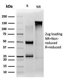 SDS-PAGE analysis of Anti-JAZF1 Antibody [PCRP-JAZF1-1C2] under non-reduced and reduced conditions; showing intact IgG and intact heavy and light chains, respectively. SDS-PAGE analysis confirms the integrity and purity of the antibody.