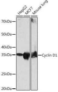 Western blot analysis of extracts of various cell lines, using Anti-Cyclin D1 Antibody [ARC0300] (A306339) at 1:1000 dilution. The secondary Antibody was Goat Anti-Rabbit IgG H&L Antibody (HRP) at 1:10000 dilution. Lysates/proteins were present at 25 µg per lane