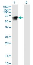 Anti-GRB7 Mouse Monoclonal Antibody [clone: 3C12]