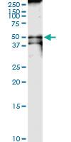 Anti-CKMT1B Polyclonal Antibody Pair