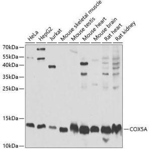 Anti-COX5A Antibody (A9867)