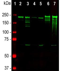 Western blot analysis of tissu