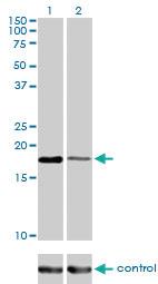 Anti-BIRC5 Mouse Monoclonal Antibody [clone: 5B10]