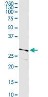 Anti-PRSS21 Rabbit Polyclonal Antibody