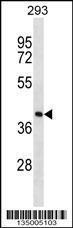 Anti-FDPS Rabbit Polyclonal Antibody (FITC (Fluorescein Isothiocyanate))