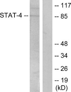 Anti-STAT4 Rabbit Polyclonal Antibody