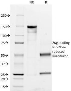 SDS-PAGE analysis of Anti-CD45RO Antibody [UCHL-1] under non-reduced and reduced conditions; showing intact IgG and intact heavy and light chains, respectively SDS-PAGE analysis confirms the integrity and purity of the antibody