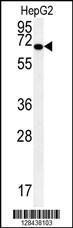 Anti-KEAP1 Rabbit Polyclonal Antibody (Biotin)