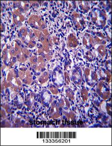 Anti-B4GALNT3 Rabbit Polyclonal Antibody (FITC (Fluorescein Isothiocyanate))