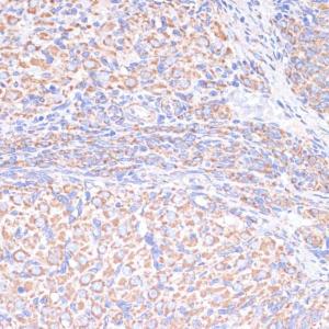 Immunohistochemistry analysis of paraffin-embedded rat ovary using Anti-COX5A Antibody (A9867) at a dilution of 1:100 (40X lens). Perform microwave antigen retrieval with 10 mM PBS buffer pH 7.2 before commencing with IHC staining protocol