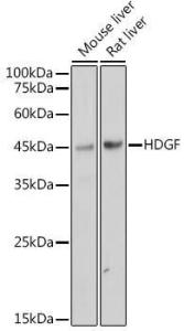 Anti-HDGF Rabbit Monoclonal Antibody [clone: ARC2522]