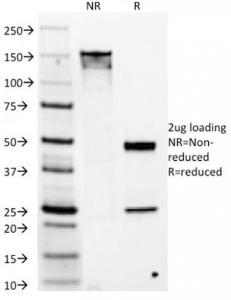 SDS-PAGE analysis of Anti-TMEM16A Antibody [DG1/1486] under non-reduced and reduced conditions; showing intact IgG and intact heavy and light chains, respectively. SDS-PAGE analysis confirms the integrity and purity of the antibody.