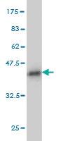 Anti-PUM2 Mouse Monoclonal Antibody [clone: 7B8]