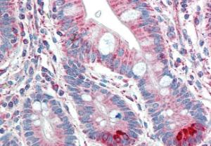 Anti-TMPRSS5 Antibody (A83817) (5 µg/ml) staining of paraffin embedded Human Small Intestine. Steamed antigen retrieval with citrate buffer pH 6, AP-staining