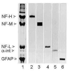 Rat spinal cord homogenate showing the major intermediate filament proteins of the nervous system (Lane 1). The remaining lanes show blots of this material stained with various antibodies including Anti-NF-H Antibody (Lane 2).