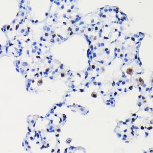 Immunohistochemistry analysis of paraffin-embedded rat lung using Anti-Cyclin D1 Antibody [ARC0300] (A306339) at a dilution of 1:100 (40X lens). Perform high pressure antigen retrieval with 10 mM citrate buffer pH 6.0 before commencing with IHC staining protocol