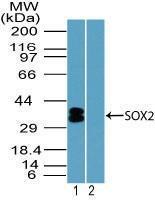 Anti-SOX2 Rabbit Polyclonal Antibody