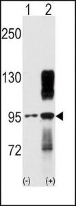 Anti-DDR2 Rabbit polyclonal antibody