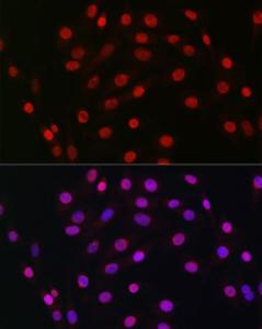 Anti-HDGF Rabbit Monoclonal Antibody [clone: ARC2522]