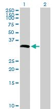 Anti-CYB5R1 Mouse Polyclonal Antibody