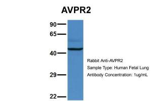 Anti-AVPR2 Rabbit Polyclonal Antibody