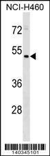 Anti-HEPACAM2 Rabbit Polyclonal Antibody (HRP (Horseradish Peroxidase))