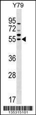 Anti-FDXR Rabbit Polyclonal Antibody (AP (Alkaline Phosphatase))