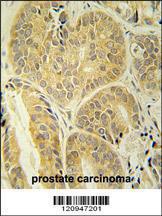 Anti-ENAM Rabbit Polyclonal Antibody (HRP (Horseradish Peroxidase))