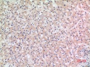 Anti-NLRP3 Rabbit Polyclonal Antibody