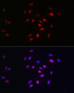 Anti-HDGF Rabbit Monoclonal Antibody [clone: ARC2522]