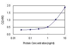 Anti-STK16 Polyclonal Antibody Pair