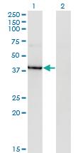 Anti-HDAC8 Mouse Monoclonal Antibody [clone: 2F4]